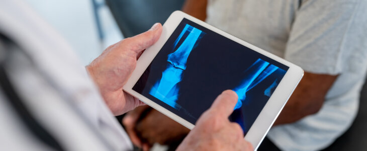 Close up of unrecognizable orthopedist looking at an x-ray of senior patient on a digital tablet - Healthcare concepts